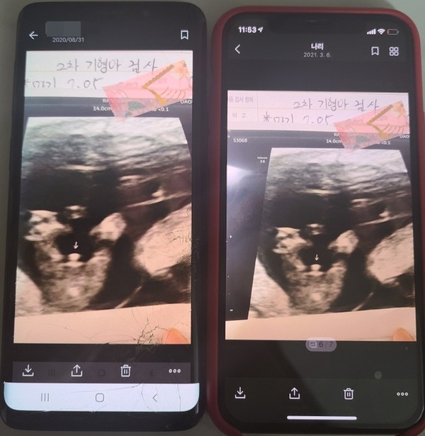 무당이 형에게 보낸 임신초음파 사진과, 동생의 아내가 지인한테서 받은 임신초음파 사진은 똑같았다. 무당의 임신은 거짓말이었다.